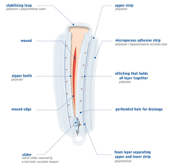 SurgiZip Surgical Zipper